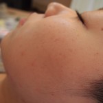 女性の口元の産毛は意外と目立っている！？
